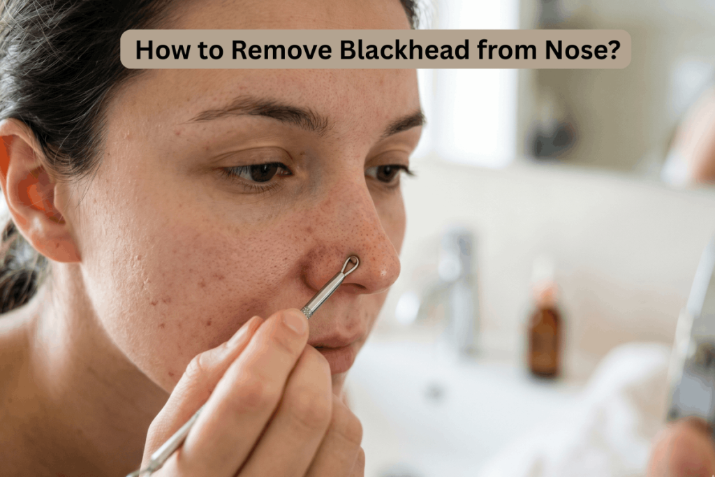 How to Remove Blackhead from Nose?