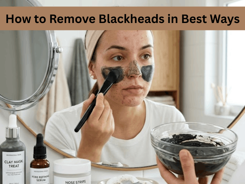 How to Remove Blackheads in Best Ways